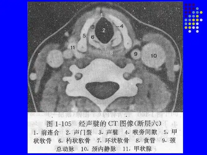 (共36页,当前第23页) 你可能喜欢 最全人体解剖图 颈部淋巴结分区 ct