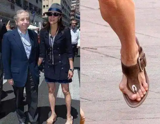 女星脚太丑杨紫琼宋茜畸形王子文满是伤疤金星为脚骄傲