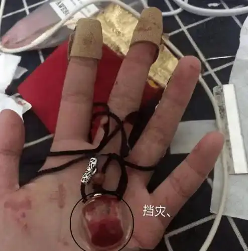 更有甚者,直接拿着修眉刀 割腕,割手臂,只为装满那个廉价的磨砂瓶.