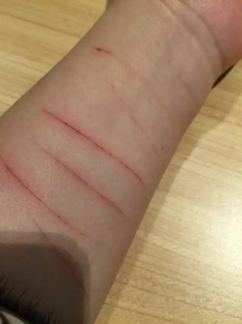 手腕被刀割伤的照片,刀割手腕的照片伤口-图片大观-奇异网