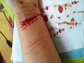 自残手流血的照片手腕上抹点动物的血弄把刀也