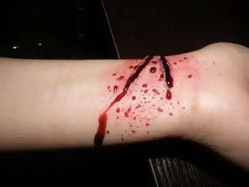 河南我不活了和家人吵架后少年往手腕割三刀激动跳河自杀