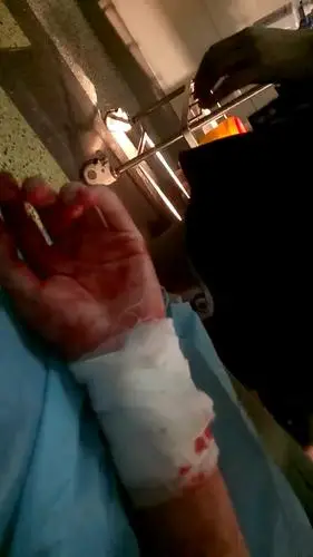 我是早想死了,一个月前割过一次腕,只不过很可惜,在用修眉刀割开手腕