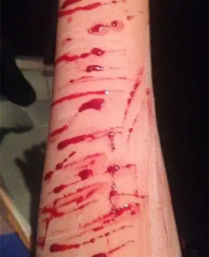 微博中,她上传了一张鲜血淋漓的手臂照片,手臂上满是小刀自残的划痕.