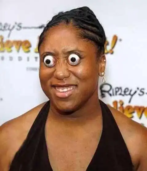 图为:世界上腿最多的女人.她有四条腿,是世界上唯一成年的四条腿女人.