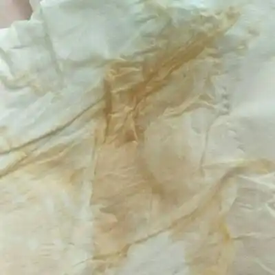 怀孕十周,睡觉期间流了黄水,然后还带点血水,怎麼回事,家里没人,没