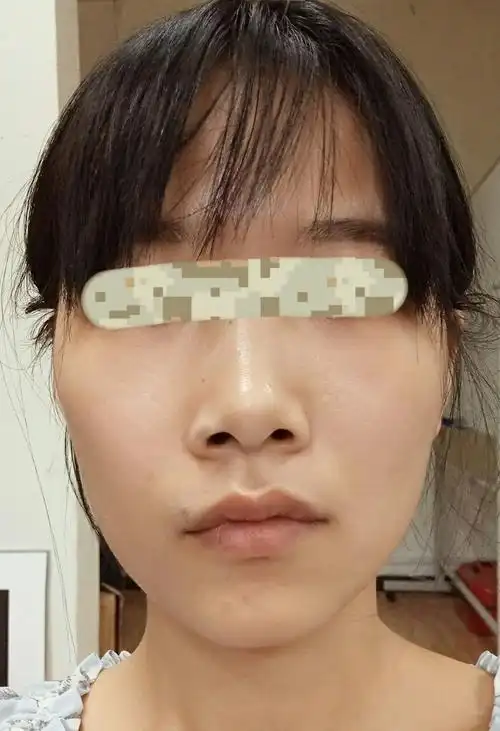 颧骨一大一小 嘴和下巴笑起来是歪的 - 知乎