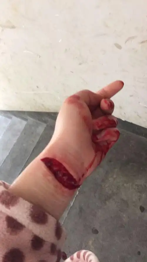 非常伤心 一时冲动下用了右手毕生之力和全新的锋利刀片 在左手手腕儿