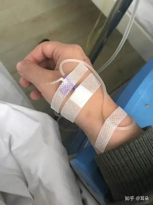 打针已经达到手背上了,暴风哭泣.