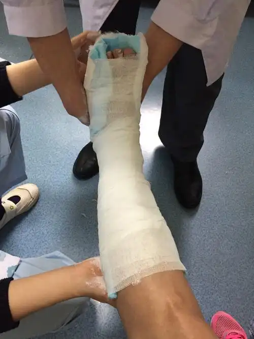 石膏固定应该注意什么?