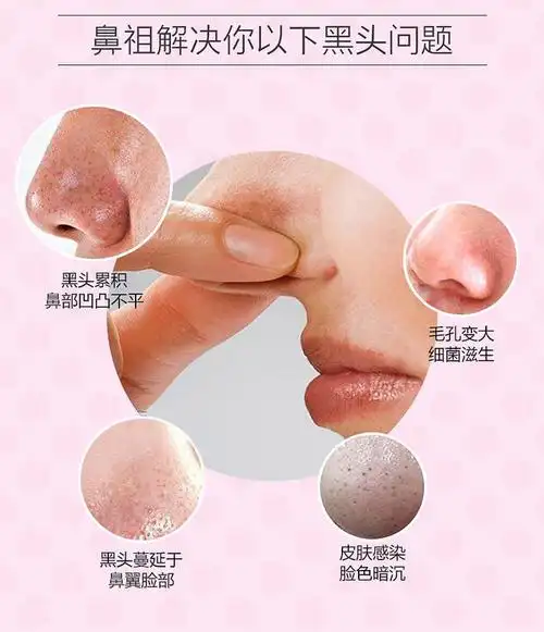 holika韩国进口正品去黑头粉刺猪鼻贴三部曲收缩毛孔清洁鼻头-tmall.